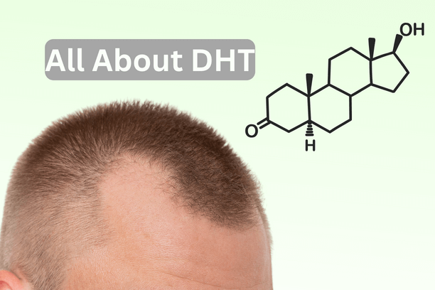 Dihydrotestosterone-DHT side effects on hair loss